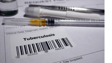 Haryana Detects Over 25,600 New TB Cases Through AI-Driven Screening Campaign, Strengthens Push Towards TB-Free State